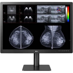 LG 31HN713D-B 31" 12MP Diagnostic Monitor