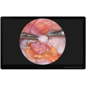Lilliput Aimedik MD31 31.5" UHD 4K Surgical Monitor